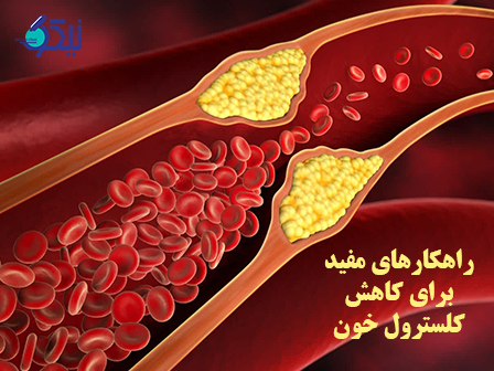 9 راهکار مفید برای کاهش کلسترول خون 