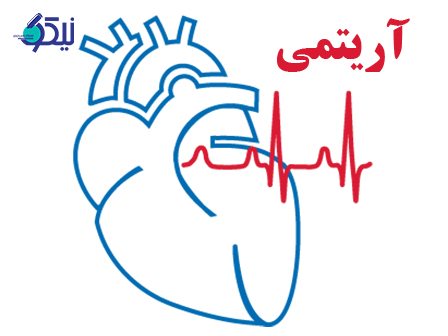 تشخیص آریتمی قلبی چگونه صورت می گیرد؟