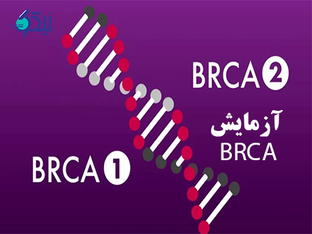 آزمایش ژن BRCA در تشخیص سرطان سینه