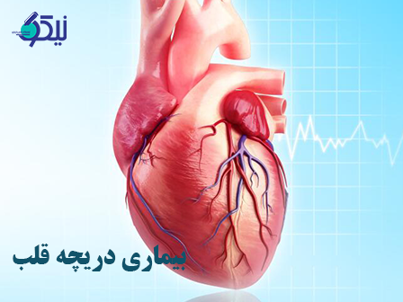 آزمایشات تشخیص بیماری دریچه قلب در دقیقترین آزمایشگاه شمال تهران