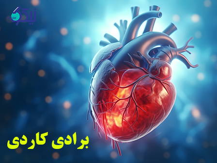 برادی کاردی چیست؟ علائم، تشخیص و درمان