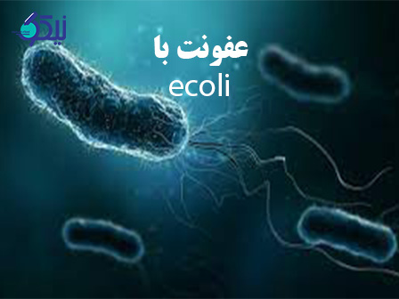 عفونت E.coli چیست و چه علائمی دارد؟