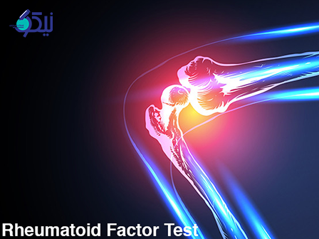 آزمایش RF چیست؟