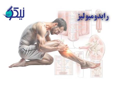 رابدومیولیز چیست؟