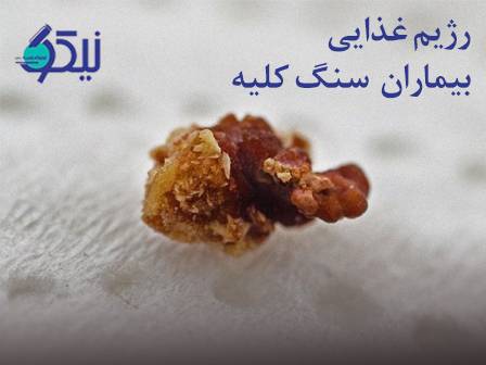 رژیم غذایی مناسب برای بیماران سنگ کلیه؛ نکات طلایی برای پیشگیری و درمان