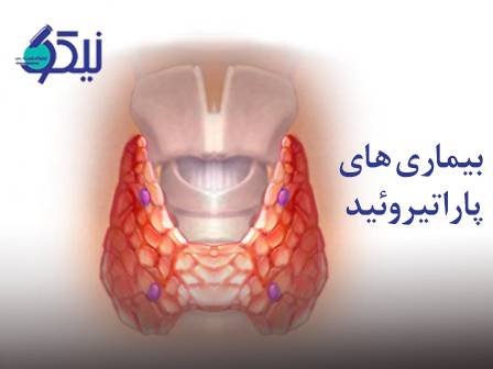 بیماریهای پاراتیروئید؛ وقتی تعادل کلسیم بدن به هم میریزد!