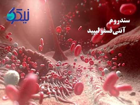 سندرم آنتی‌فسفولیپید: تشخیص با آزمایش‌های اختصاصی خون