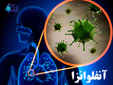 آنفلوانزا چیست؟