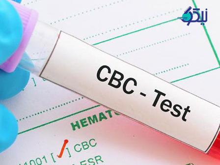 آزمایش شمارش کامل سلولهای خون (CBC) 