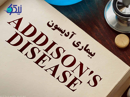  بیماری آدیسون چیست؟ چگونه بیماری آدیسون را درمان کنیم؟