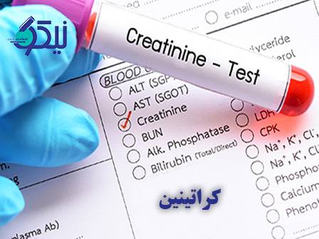 کراتینین؛ شاخص مهم برای بررسی سلامت کلیه‌ها