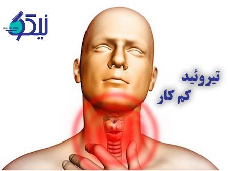 باور نمیکنی که این غذاها تیروئید کمکار را بیدار میکند!