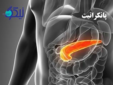 پانکراتیت؛ از علائم اولیه تا تشخیص آزمایشگاهی با تست آمیلاز و لیپاز