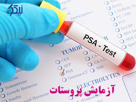 چرا آزمایش PSA باید در دقیقترین آزمایشگاه انجام می شود؟