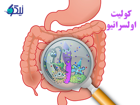 جوابدهي آنلاين براي آزمايش کوليت اولسراتيو در آزمايشگاه نيکو