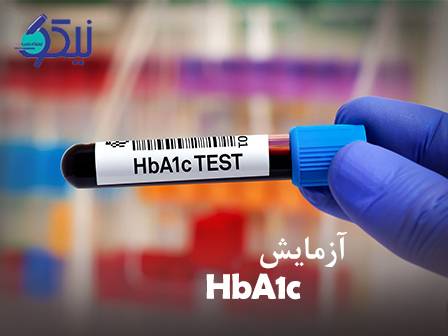 آزمایش HbA1c چیست و چرا برای کنترل دیابت حیاتی است؟
