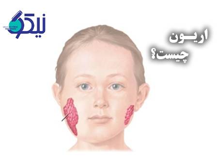 اوریون چیست؟