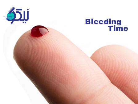 بررسی اختلالات خونریزی‌دهنده با آزمایش  Bleeding Time
