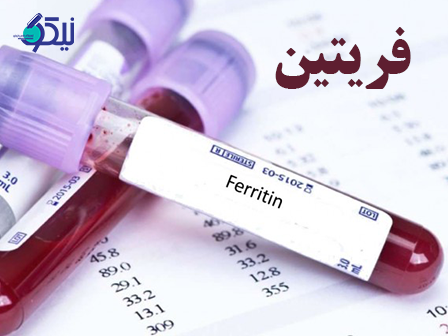  آزمایش فریتین (Ferritin Test) چیست؟