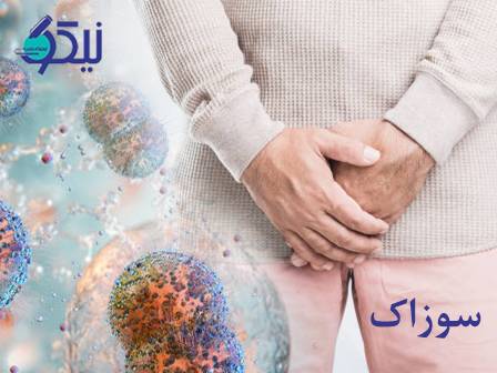 سوزاک، تعریف، علائم و راه تشخیص