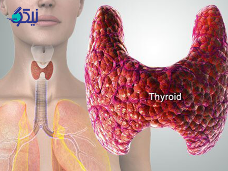 خبرنامه تشخیص بیماریهای تیروئید